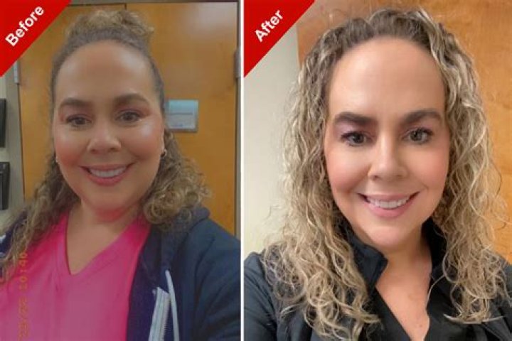 Caroline Manzo Reveals Plastic Surgery She’s ‘Thrilled’ With: See Before & After Pics